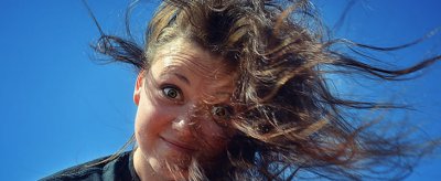 额头皮肤松弛怎么办 皮肤松弛的原因