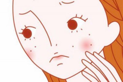 痤疮是由什么引起的？原因有哪些？