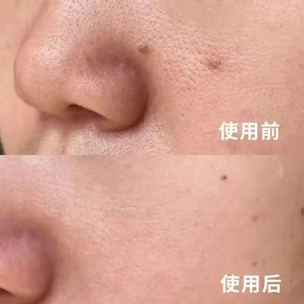 日本资生堂红腰子精华怎么样