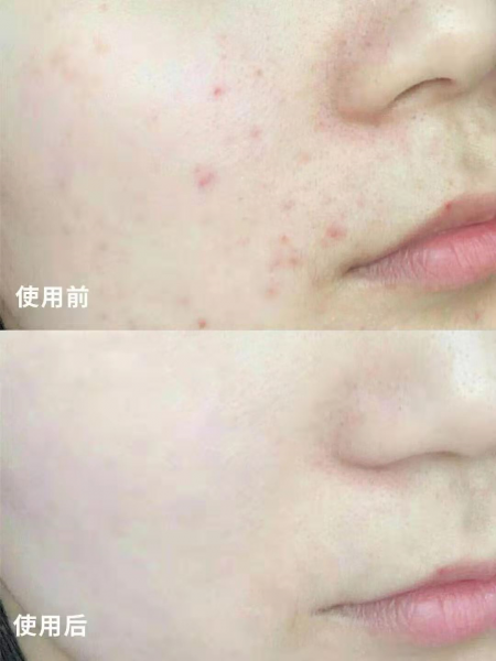 日本资生堂红腰子精华怎么样