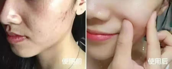 日本资生堂红腰子精华怎么样
