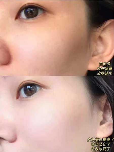 日本资生堂红腰子精华怎么样