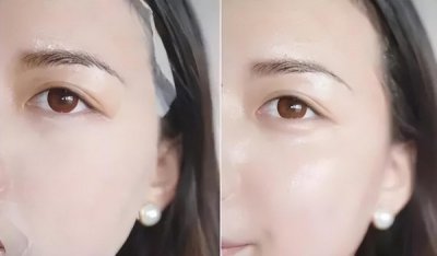 玻色因和A醇哪个好用 玻色因和A醇谁大PK