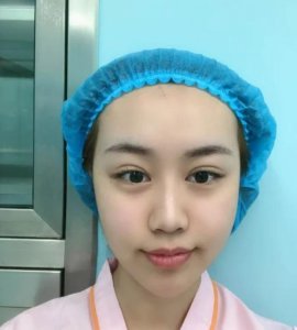 整容臉怎么看得出來(lái)？