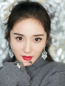 怎么导致发际线后移 发际线后移是怎么造成的？