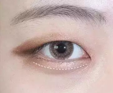 单眼皮眼型有哪些