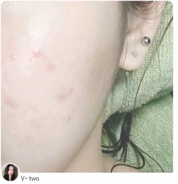 透真377美白精华液怎样