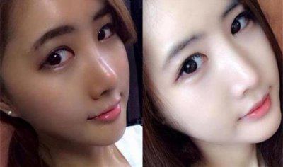晒黑了怎么快速变白 掌握美白小贴士告别“黑炭”不再是梦！