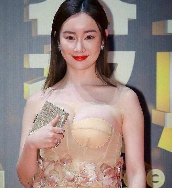 整容有什么危险和风险？