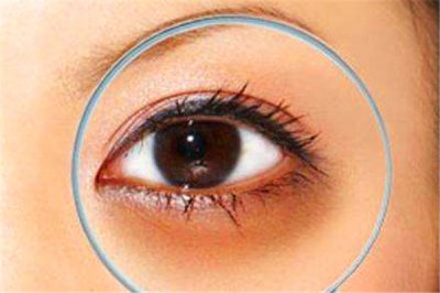 最近有黑眼圈怎么消除？引起黑眼圈原因是什么？