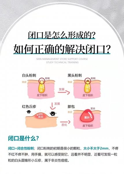 如何解决闭口