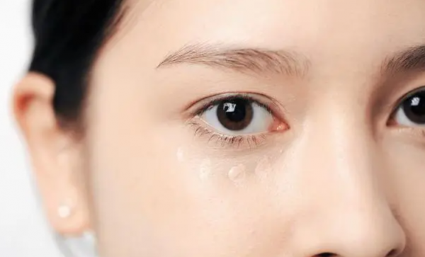 眼纹怎么改善