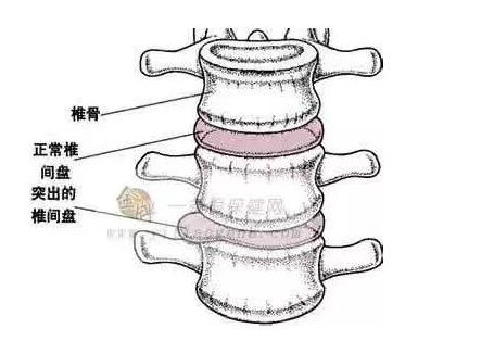 做力量训练可以减肥吗？