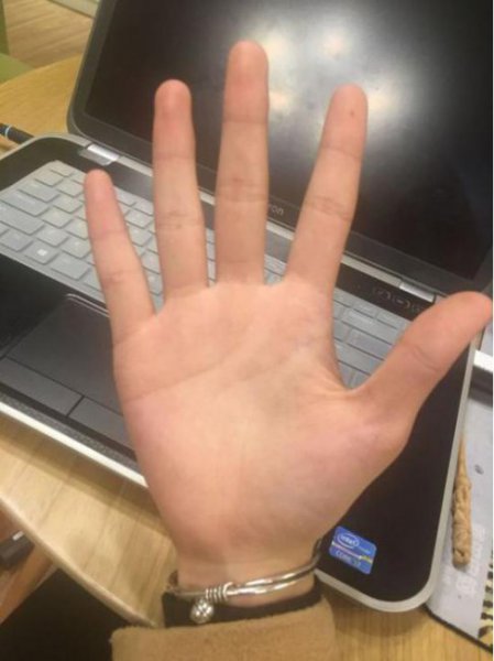 人的手型有几种类型？