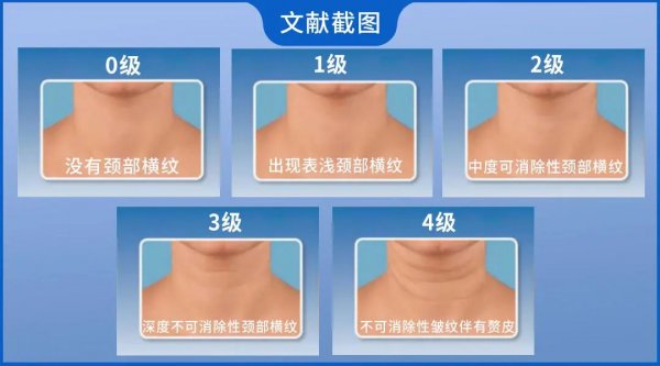 如何才能去除颈纹