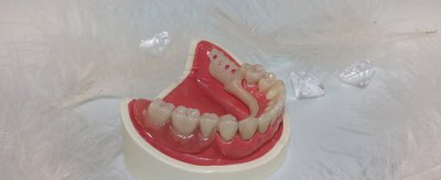 牙齿黄怎么办 牙齿黄要怎么改善