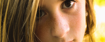 改善皮肤暗沉的方法有哪些 使用含有维生素C的护肤品