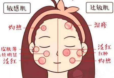 五大皮肤的分类及特点