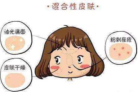 五大皮肤的分类及特点