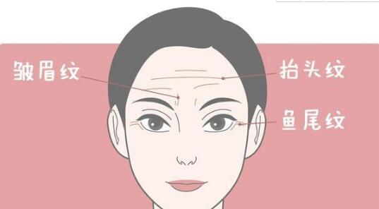 动态皱纹怎么去除的方法