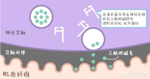 动态皱纹怎么去除的方法