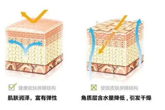 脸部皮肤缺水怎么办？