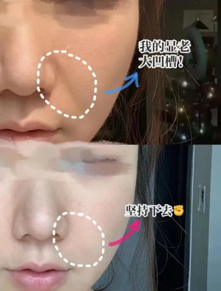 初普美容仪怎样