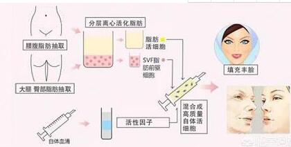 木偶纹怎么形成的