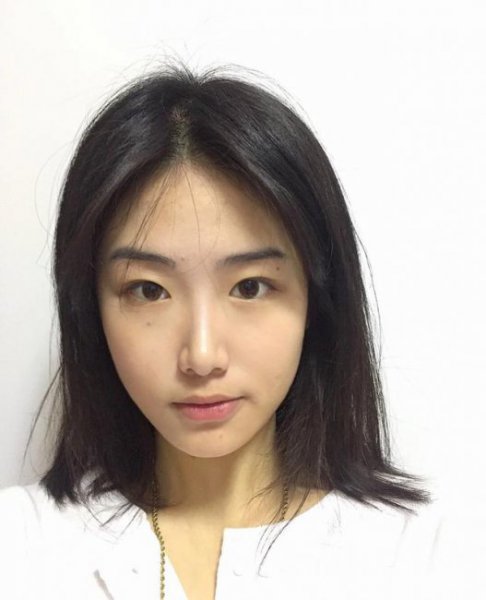 唇部整形有什么风险？
