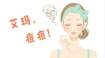 祛痘小妙招 对于痘痘的总结分析