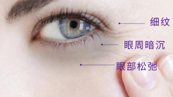 睡不着失眠导致长黑眼圈怎么办