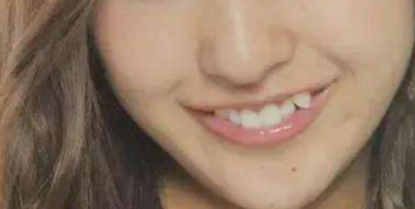 为什么女孩子有虎牙不能娶