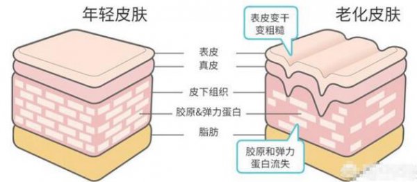 眼睛有皱纹该怎么办消除的方法？