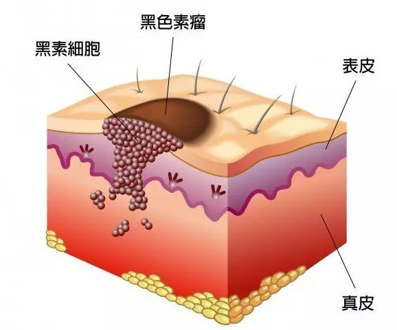 脸上底层的黑色素怎么代谢掉