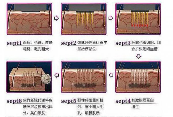 脸上出现红血丝是怎么回事？