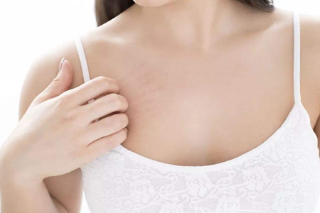 女性皮肤瘙痒是怎么回事？