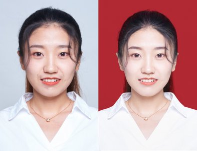 拍（S-F-Z）会帮你p痘痘吗 拍（S-F-Z）好看的小技巧