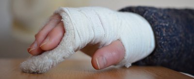 冻疮是怎么形成的 冻疮是怎样形成的