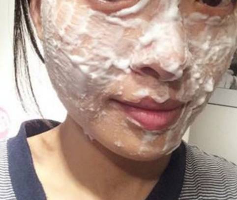阿莫西林真的可以去黑头吗