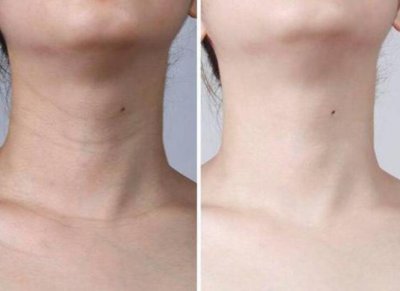 如何练成天鹅颈简单 天鹅颈怎么练？是什么样的标准