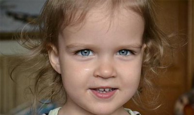 去眉间纹最好的方法 一解诸位的燃眉之急好让你显青春靓丽