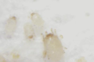 脸上有螨虫怎么办？需要做好这四个方面