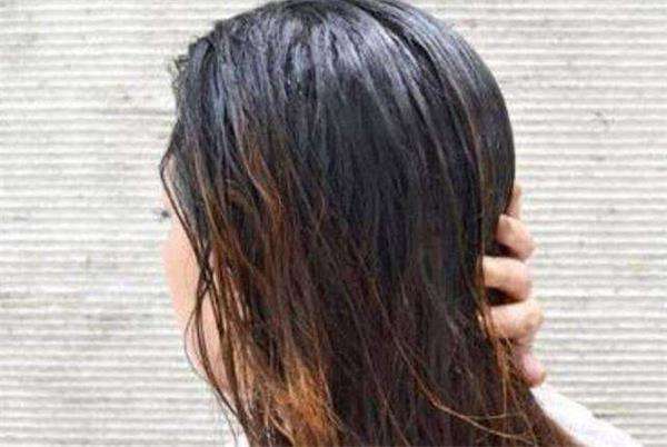 头发油腻有什么好办法？