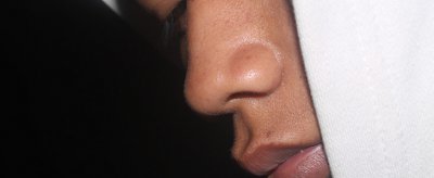 鼻子毛孔粗大怎么修复 毛孔粗大的注意事项