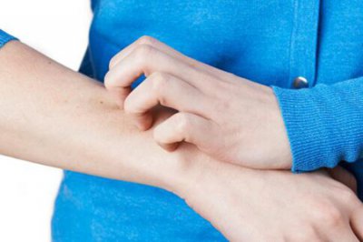 冬季皮肤干痒缓解的方法 秋季干燥皮肤瘙痒怎么办