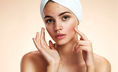 秋天洗脸后皮肤干燥怎么办 秋季护肤小常识