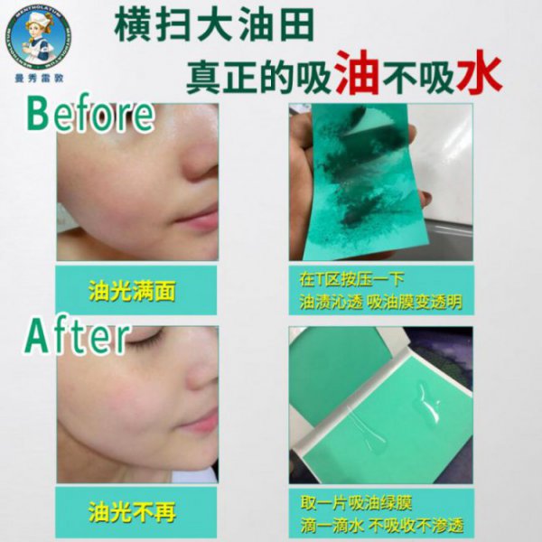 脸上头上出油特别多