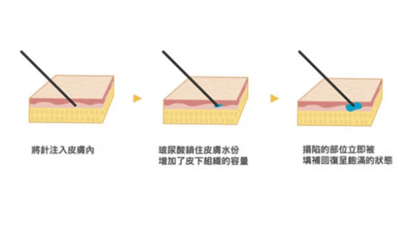 抗衰的方法有哪些