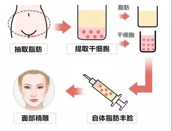 抗衰的方法有哪些