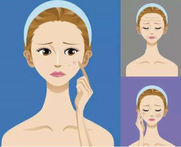 m22光子嫩肤多久做一次 光子嫩肤效果能维持多久